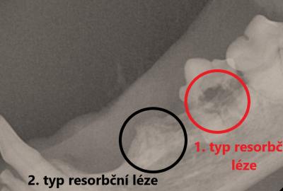 Stomatologické potíže koček - Veterinární klinika Medipet Zlín