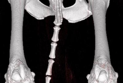 Koleno s artrózou - Artróza: viditelné kostní výrůstky (osteofyty), deformace a zdrsnění. Každý pohyb s takovým nálezem je jako chůze s pískem v kloubu