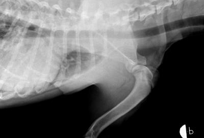 RTG Osteochondrózy (OCD)
