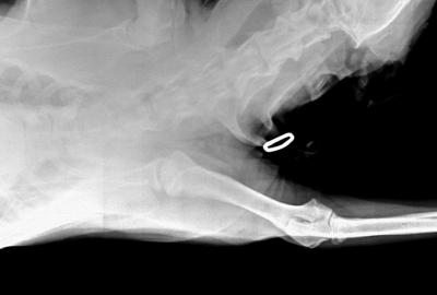 RTG Dysplazie loketního kloubu (DLK)